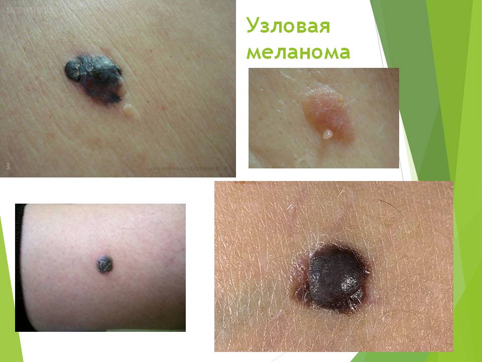 Слайд12