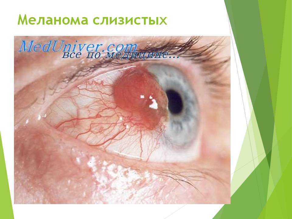 Слайд18