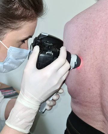 derma4